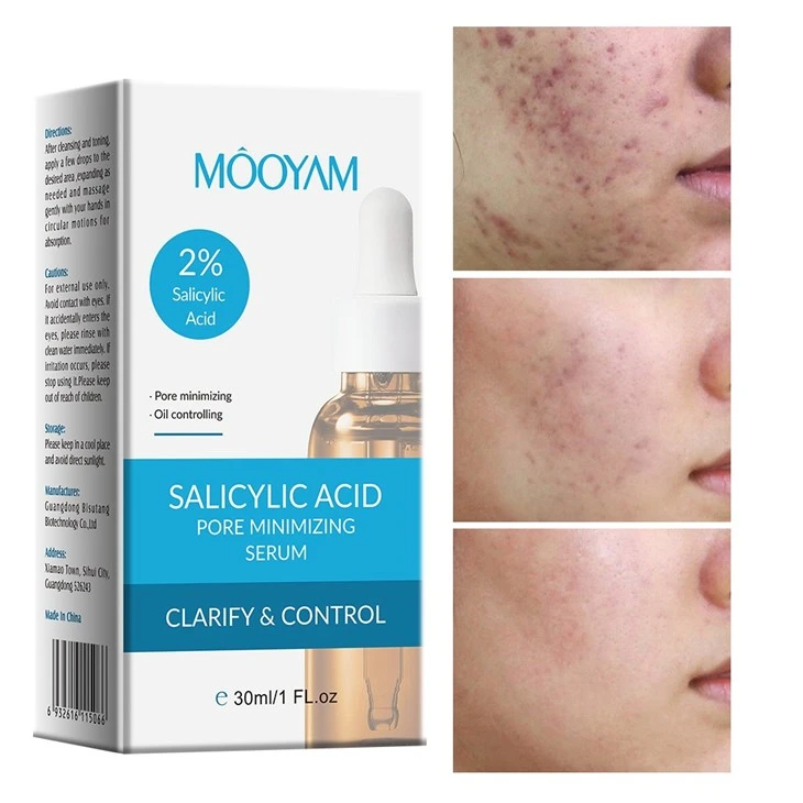 MOOYAM 2% Salicylic Acid Pore Minimizing Serum – Clear, Smooth, & Oil-Free Skin